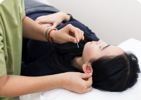 Acupuncture